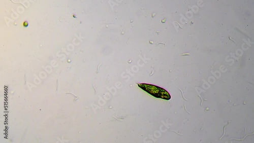 microorganisms in a drop of water from a freshwater lake