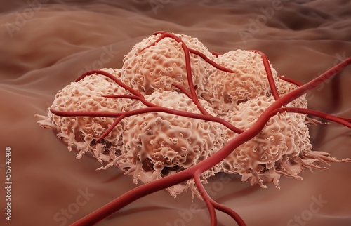 Blood supply to cancer cells photo