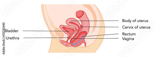 Prolapses rectocele Female reproductive system uterus diagram with inscriptions. Side view in a cut. Human anatomy internal organs flat style icon. Vector medical illustration color concept isolated