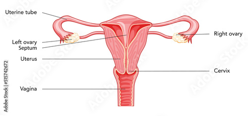 Uterine septum septate uterus Female reproductive system diagram with inscriptions text. Human anatomy internal organs scheme, cervix, ovary, fallopian tube flat Vector medical illustration isolated