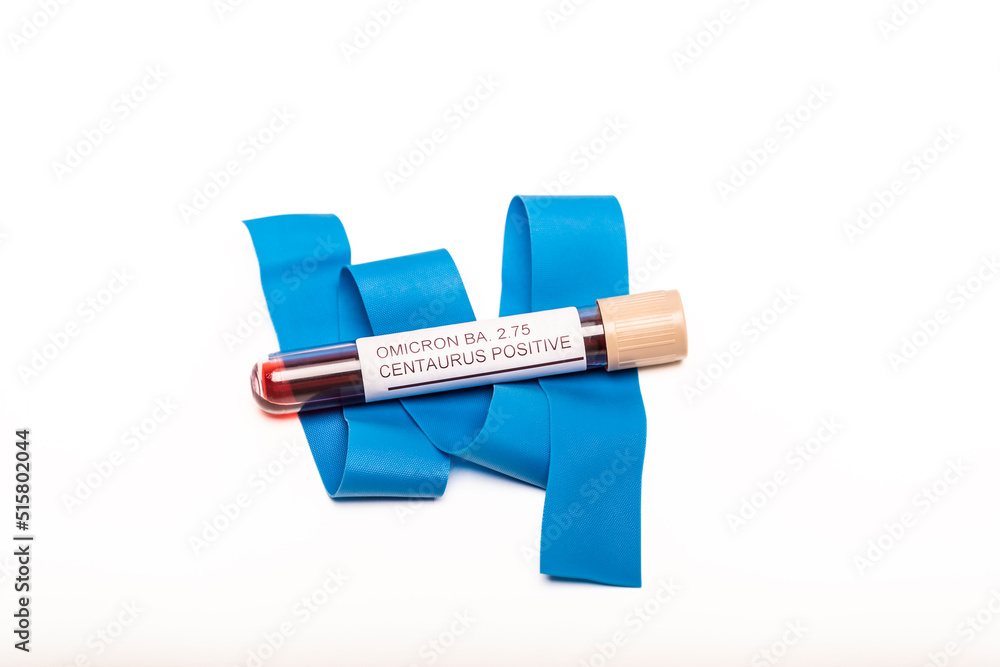 Coronavirus 2019-nCoV variant CENTAURUS BA.2.75 Blood Sample. New Epidemic Corona Virus. Coronavirus 2019-nCoV variant CENTAURUS BA.2.75 Blood Sample. New Epidemic Corona Virus.