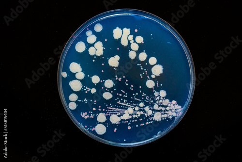 Petri dish with biological samples From a medical laboratory