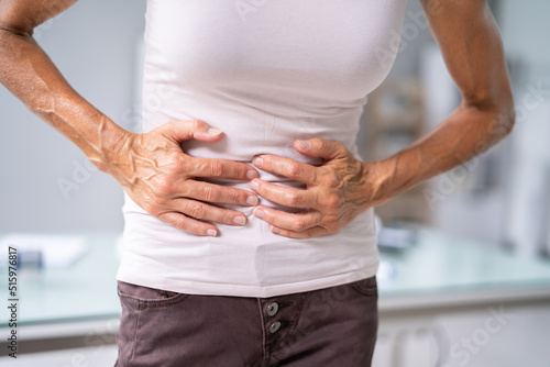 Diverticulitis Infection Or Inflammation In Intestines