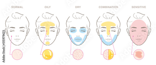 Types of women's skin problems. Normal, oily, dry, combination, sensitive. Vector illustration isolated on white background. photo