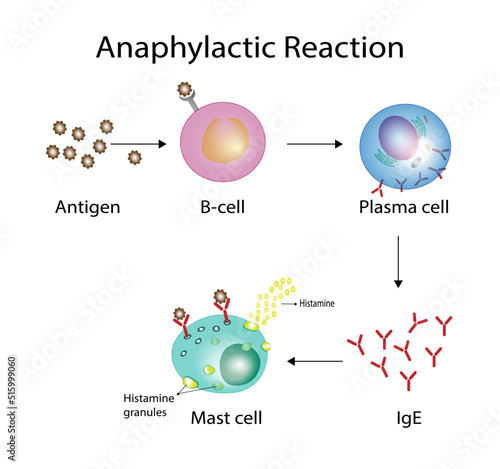 Anaphylactic reaction, allergic reaction, Autoimmune disorders, allergy and anaphylaxis. Mast cells, b cell,  basophils and IgE antibodies  are in involved in Anaphylactic reaction. photo