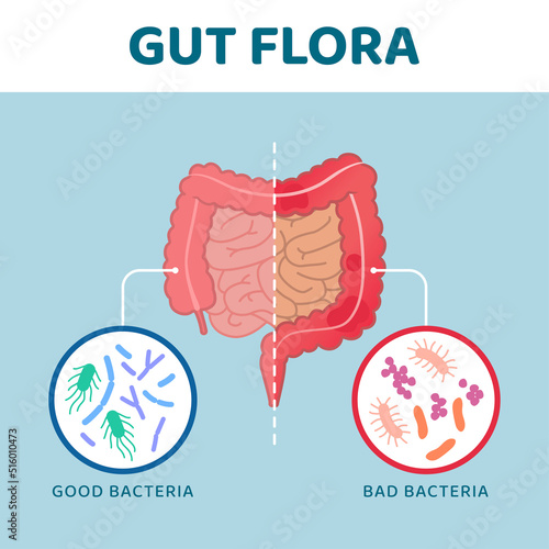 Good and bad gut bacteria