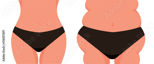 Before and after weight loss concept. Body overweight and slender body of a woman in underwear close-up. Fat and slim women vector illustration. Fight with obesity, Slim waist compared to body fat