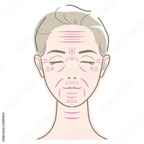 Types of wrinkles on face of woman. Vector illustration isolated on white background.