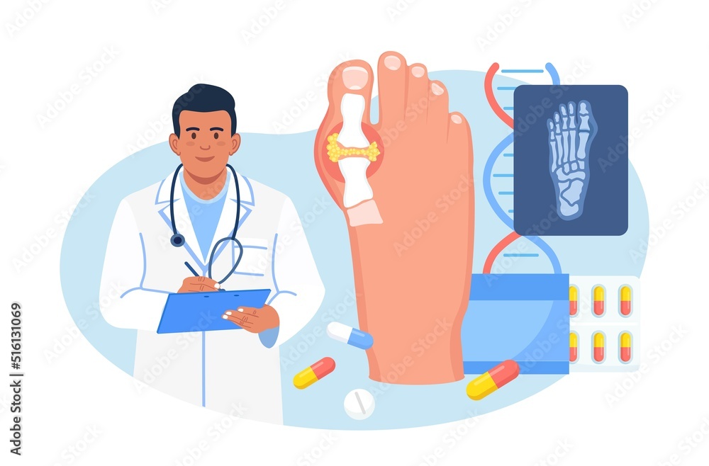 Gout treatment. Arthritis joint in the ankle. Doctor diagnoses swollen