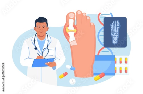 Gout treatment. Arthritis joint in the ankle. Doctor diagnoses swollen and inflamed foot joint. Physician looking at x-ray scan. Human feet bone with uric acid crystals. Medical appointment and exam