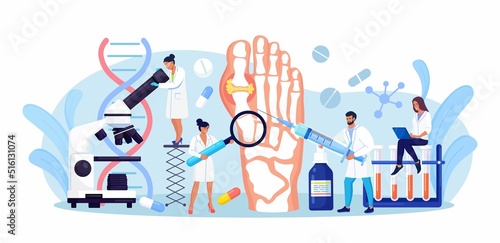 Gout treatment. Arthritis joint in the ankle. Doctor diagnoses swollen and inflamed foot joint. Physician examination human feet bone with uric acid crystals. Medical appointment and exam