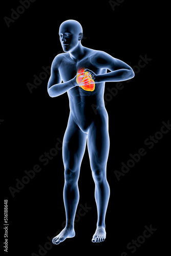 Heart attack, conceptual image for heart diseases photo