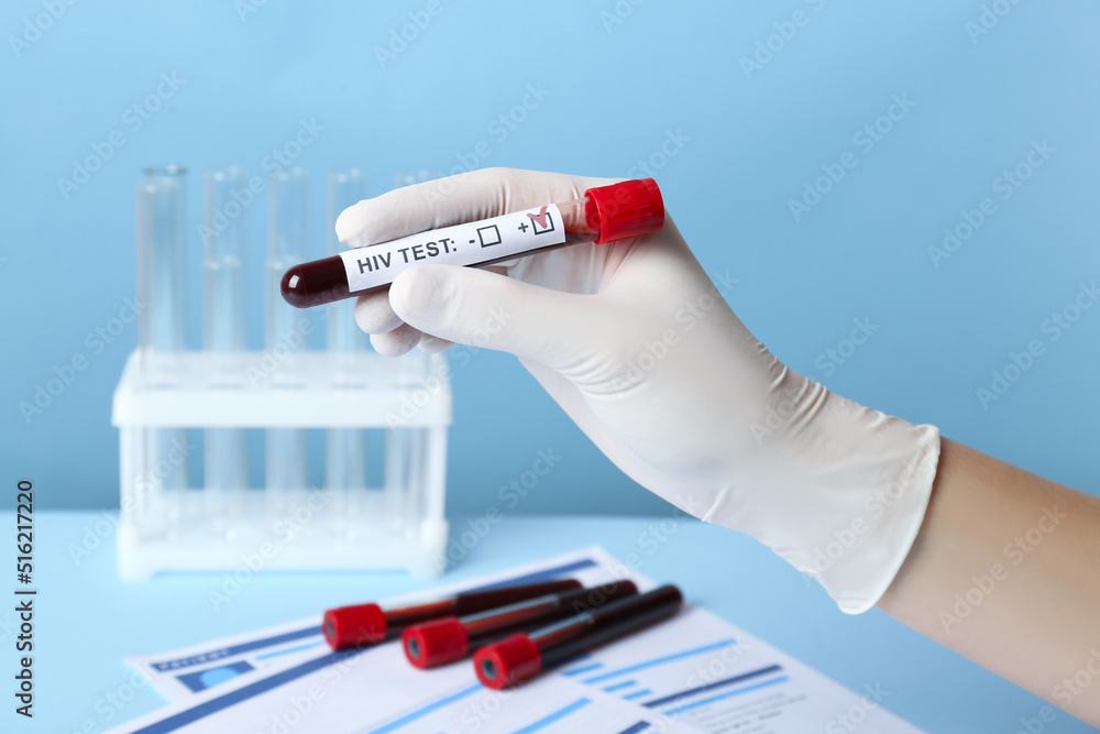 Scientist holding tube with blood sample and label HIV Test on light blue background, closeup Scientist holding tube with blood sample and label HIV Test on light blue background, closeup