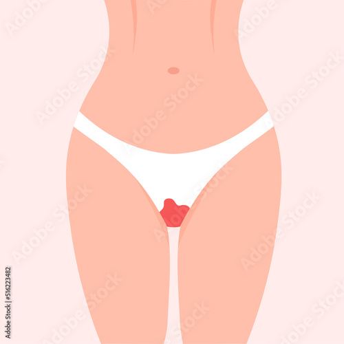 Woman thighs with blood-stained panties. Period power. Menstruation day. Menstrual protection concept. Vector illustration in trendy flat style.