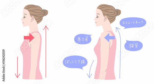 まっすぐした姿勢と猫背の女性のイラストセット