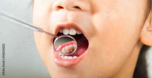 Dental kid health examination. Doctor examines oral cavity of little child uses mouth mirror to checking teeth cavity  Asian dentist making examination procedure for smiling cute little girl