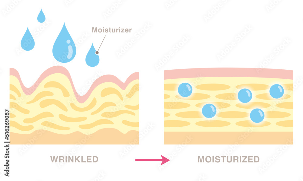 Cross section of wrinkled skin and moisturized skin. Pale colored illustration in flat cartoon style.