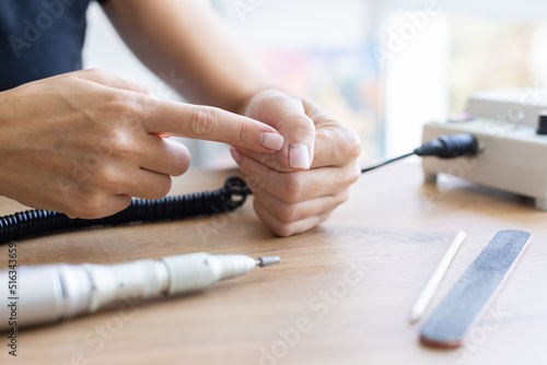 Woman showing cracked broken nails. Manicure concept.