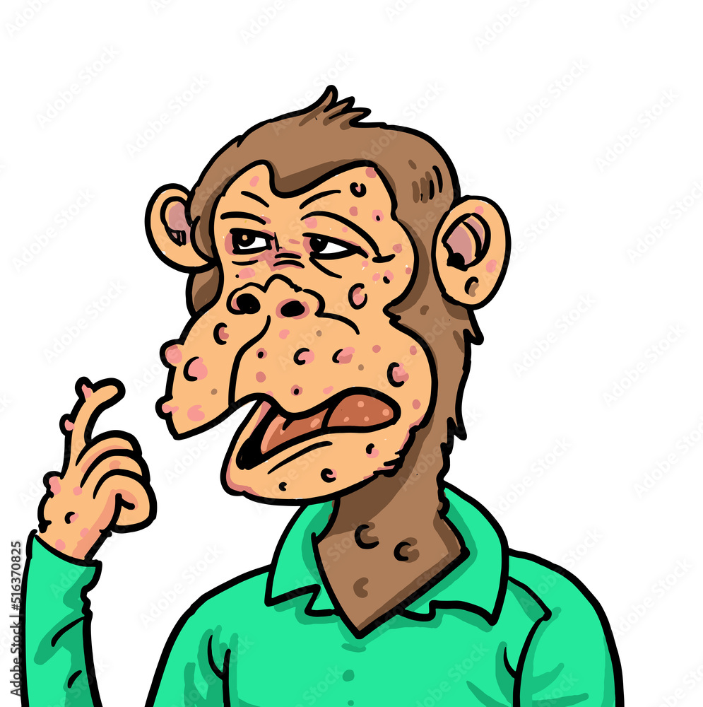 The cartoon of a monkey getting a monkeypox infection The cartoon of a monkey getting a monkeypox infection