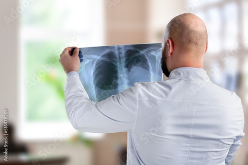 A surgeon doctor examining patient's x-ray films, scan in at radiology unit, hospital background. healthcare and medicine concept