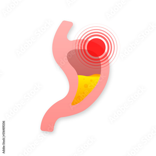 Human stomach. Healthy and unhealthy. Digestive system anatomy. Vector stock illustration.