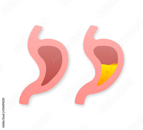 Human stomach. Healthy and unhealthy. Digestive system anatomy. Vector stock illustration.
