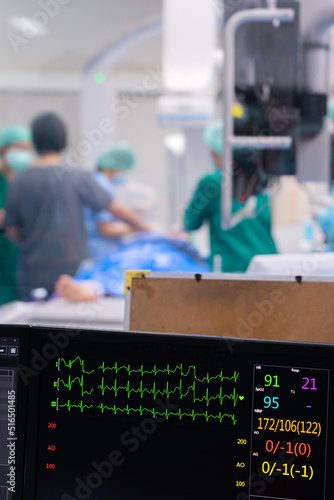 Wallpaper Mural Heart rate monitor for check ekg graph with Surgeon operates in the operating room at Hospital Torontodigital.ca