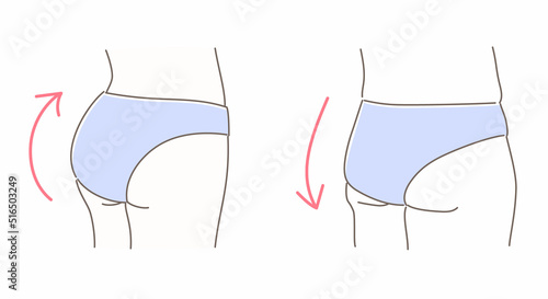 引き締まったお尻と垂れたお尻のイラストセット