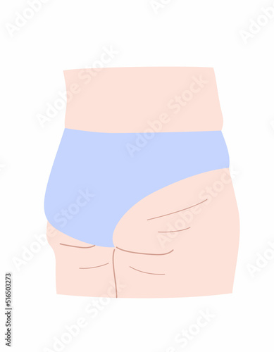 垂れてセルライトが目立つお尻のイラスト素材