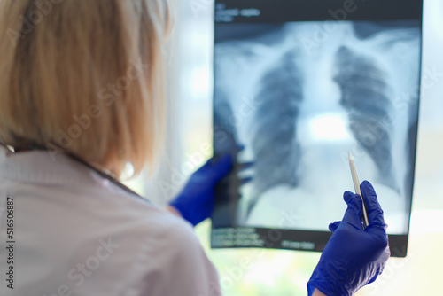 Female doctor pulmonologist holding x-ray photograph of lungs in hands photo