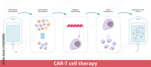 CAR-T cell therapy. Chimeric antigen receptor T cells (also known as CAR T cells) are T cells that have been genetically engineered to produce an artificial T cell receptor for use in immunotherapy photo