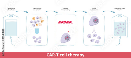 CAR-T cell therapy. Chimeric antigen receptor T cells (also known as CAR T cells) are T cells that have been genetically engineered to produce an artificial T cell receptor for use in immunotherapy