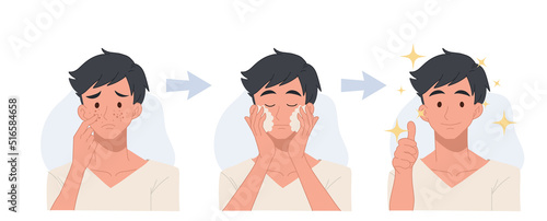 skin care concept. acne treatment before and after, facial cleansing foam, men's skin care,flat vector cartoon illustration