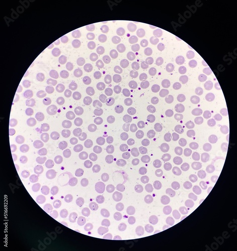 Platelet smear increase more than 25 cells in oil filed. photo