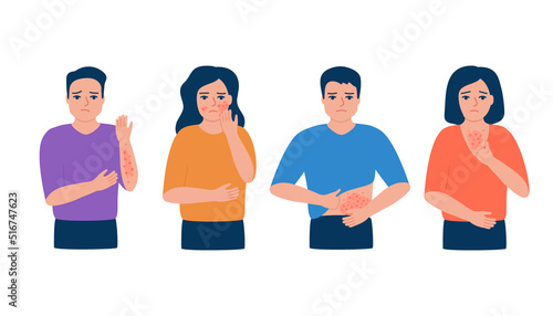 Man and woman scratching body, rash, allergy, acne on skin. People suffering from itchy skin, symptom disease. Vector illustration