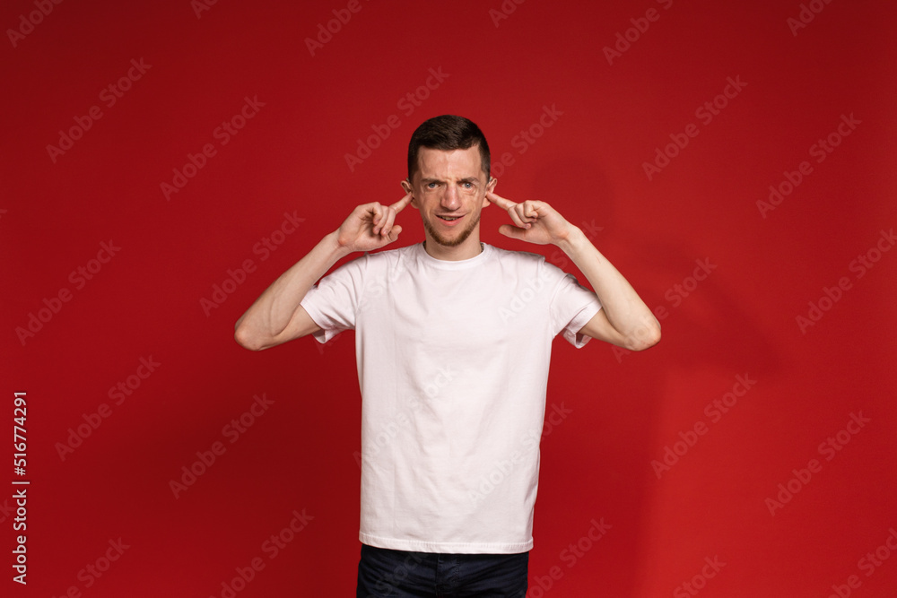 A young man with Treacher Syndrome covers his ears with his hands A young man with Treacher Syndrome covers his ears with his hands