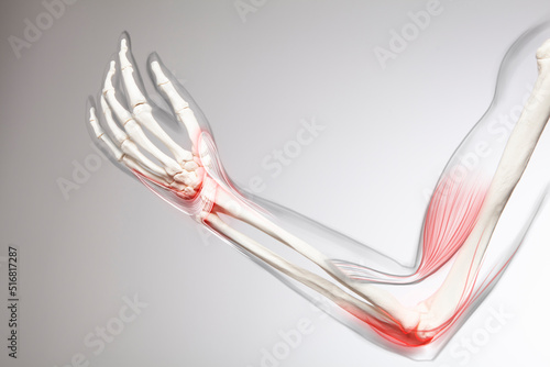 Human elbow pain, arm and bone  photo