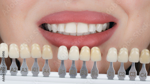 dental palette and girl's smile to determine the color of the tooth