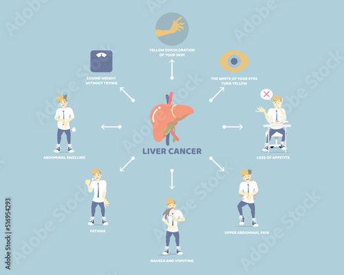 liver cancer and anatomy, health care, liver disease infographic concept, flat vector illustration cartoon character design clip art