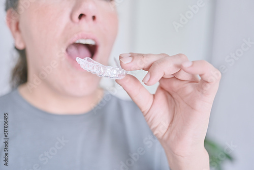 Orthodontic teeth corrector. Young woman prepares by opening her mouth to place an invisible brace made of silicone to align her teeth. Oral health.