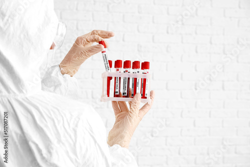 Scientist with samples of m...