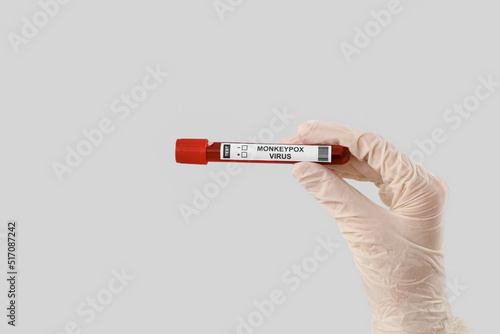 hand of scientist with samp...