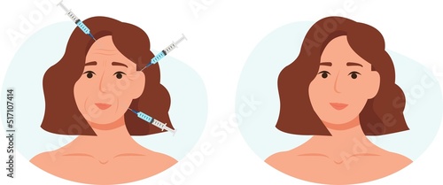 Facial injections against wrinkles and aging. Before, after.Concept of women's health and beauty, cosmetology, body and skin care.