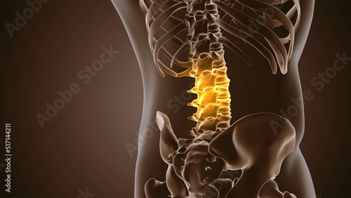 Medical background of painful back	
 photo