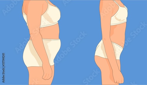 Figure befor and after from the side