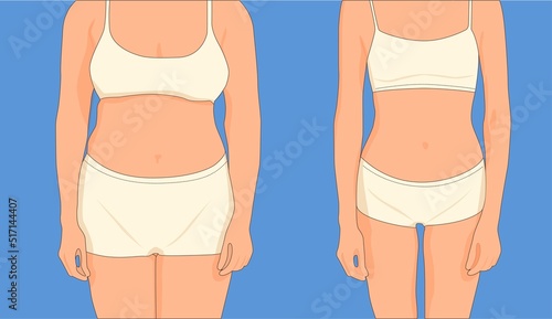 Figure befor and after from the front.