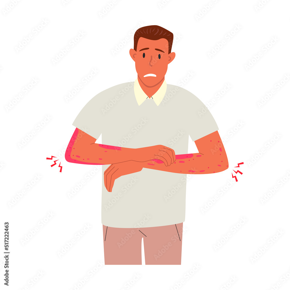 Flat vector illustration of an unhappy suffering man scratching the skin on her hand. Various skin problems, such as allergies, psoriasis, itching, atopic dermatitis, eczema, dryness, redness.