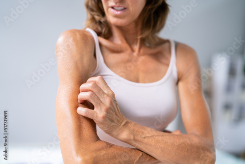 Woman With Itchy Skin