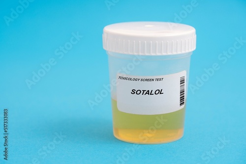 Sotalol. Sotalol toxicology screen urine tests for doping and drugs