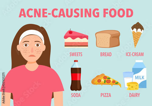 Acne causing food infographic in flat design.